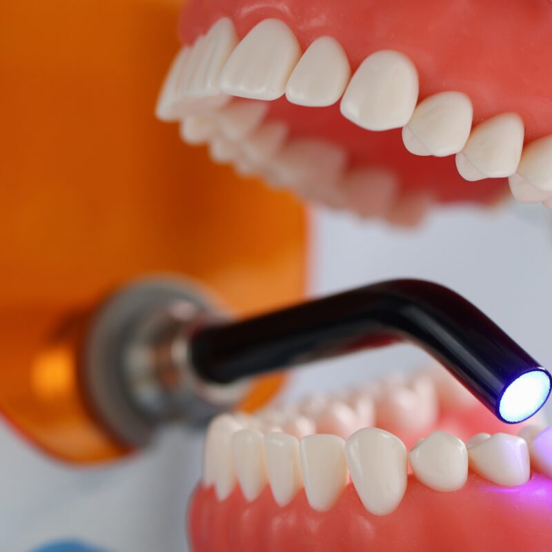 Doctor,Holds,Jaw,And,Dental,Uv,Lamp,To,Fill,Dental
