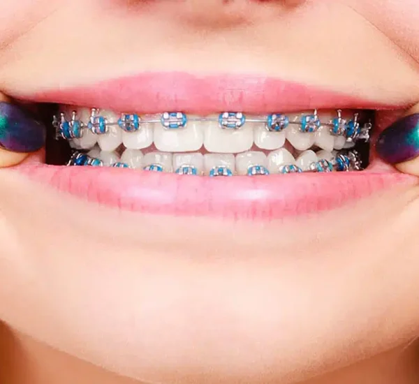 Abraces_0001_AdobeStock_205650966